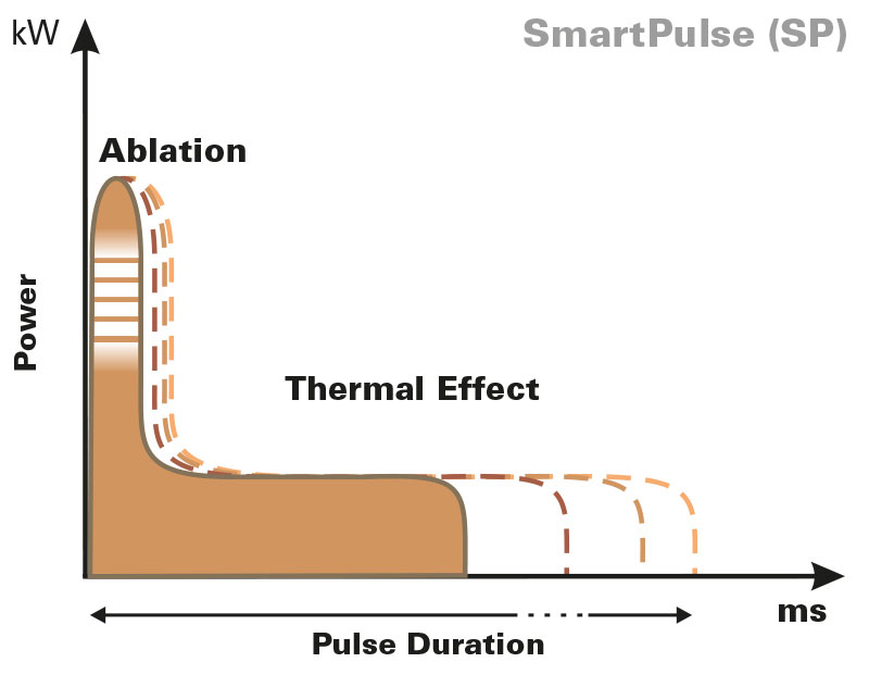 SmartPulse-fractional-laser-pulse-shapes-Punto.jpg